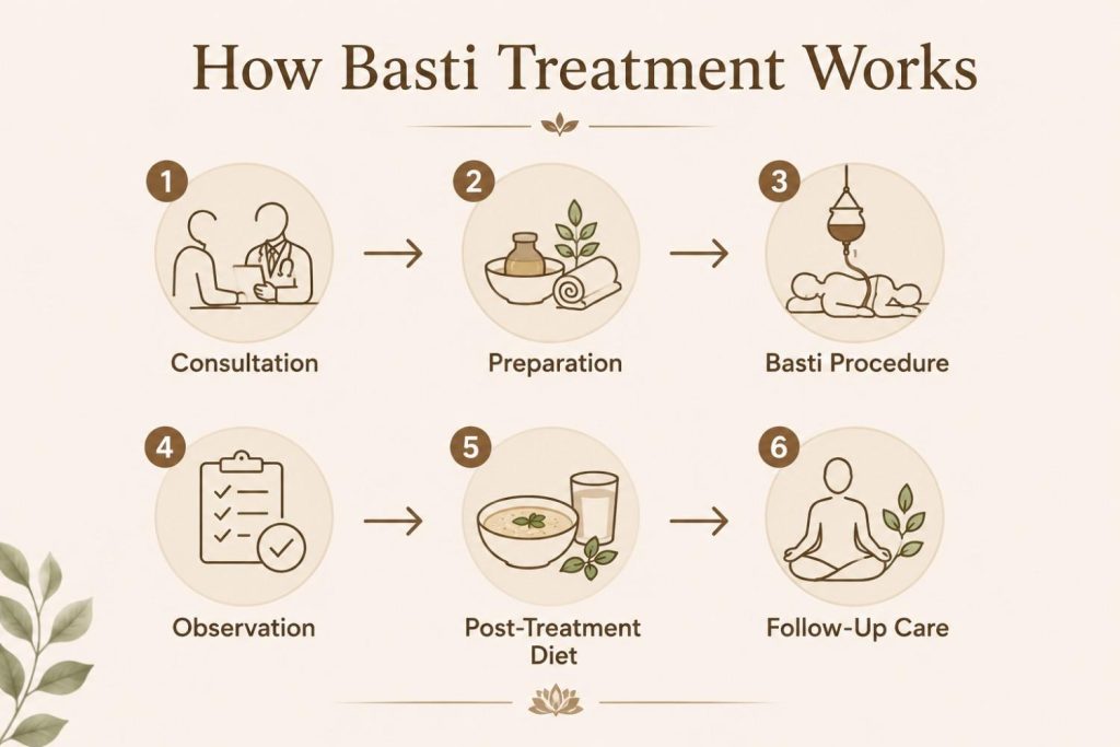 Minimal step-by-step infographic illustrating the Basti treatment process with six simple stages: Consultation, Preparation, Basti Procedure, Observation, Post-Treatment Diet, and Follow-Up Care, connected by arrows on a warm beige background.