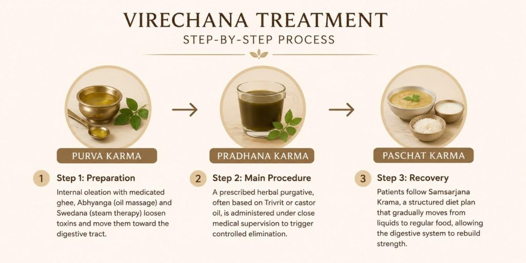Minimal step-by-step infographic illustrating the three stages of Virechana treatment: Purva Karma, Pradhana Karma, and Paschat Karma, connected with arrows and simple Ayurvedic icons on a warm beige background.